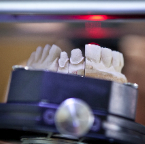 ToothTech-30
